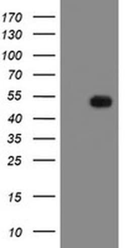 Invitrogen MRPS27 Monoclonal Antibody (OTI3D9) 100 &mu;L; Unconjugated:Antibodies,
