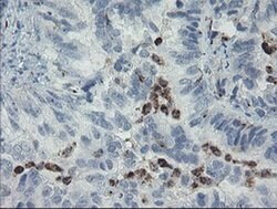 Invitrogen MYL7 Monoclonal Antibody (OTI3A8) 100 &mu;L | Buy Online | Invitrogen&trade; | Fisher Scientific