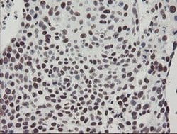 Invitrogen TPRKB Monoclonal Antibody (OTI1E9) 100 &mu;L; Unconjugated:Antibodies,