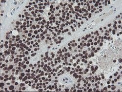 Invitrogen TPRKB Monoclonal Antibody (OTI1E9) 100 &mu;L; Unconjugated:Antibodies,