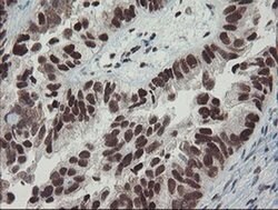 Invitrogen TPRKB Monoclonal Antibody (OTI1E9) 100 &mu;L; Unconjugated:Antibodies,