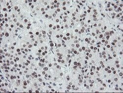 Invitrogen TPRKB Monoclonal Antibody (OTI1E9) 100 &mu;L; Unconjugated:Antibodies,
