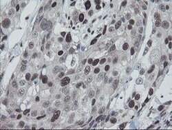 Invitrogen TPRKB Monoclonal Antibody (OTI1E9) 100 &mu;L; Unconjugated:Antibodies,