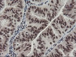 Invitrogen TPRKB Monoclonal Antibody (OTI1E9) 100 &mu;L; Unconjugated:Antibodies,