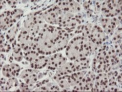 Invitrogen TPRKB Monoclonal Antibody (OTI1E9) 100 &mu;L; Unconjugated:Antibodies,