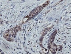 MRPS27 Monoclonal Antibody (OTI3A8):Antibodies, Monoclonal