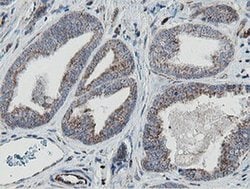 MRPS27 Monoclonal Antibody (OTI3A8):Antibodies, Monoclonal