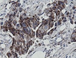 MRPS27 Monoclonal Antibody (OTI3A8):Antibodies, Monoclonal
