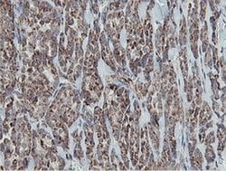 MRPS27 Monoclonal Antibody (OTI3A8):Antibodies, Monoclonal