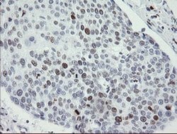 Invitrogen MAFB Monoclonal Antibody (OTI1E9) 100 &mu;L; Unconjugated:Antibodies,