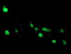 Invitrogen ARL2BP Monoclonal Antibody (OTI1A10) 100 &mu;L; Unconjugated:Antibodies,