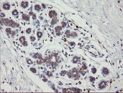 Invitrogen PHKG2 Monoclonal Antibody (OTI1F9) 100 &mu;L; Unconjugated:Antibodies,