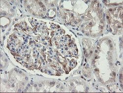 Invitrogen PHKG2 Monoclonal Antibody (OTI1F9) 100 &mu;L; Unconjugated:Antibodies,
