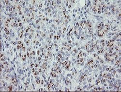 Invitrogen PHKG2 Monoclonal Antibody (OTI1F9) 100 &mu;L; Unconjugated:Antibodies,