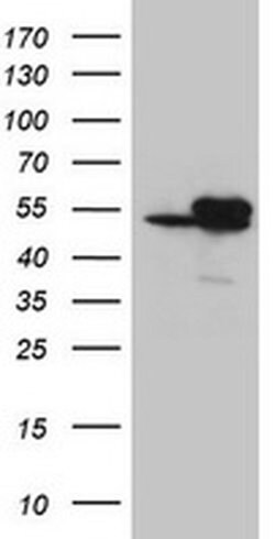 Invitrogen IDH1 Monoclonal Antibody (OTI3G9) 100 &mu;L | Buy Online | Invitrogen&trade; | Fisher Scientific