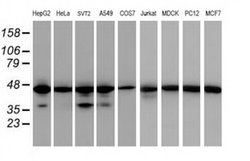 Invitrogen IDH1 Monoclonal Antibody (OTI24A2) 100 &mu;L; Unconjugated:Antibodies,