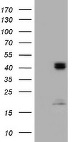 Invitrogen ACADS Monoclonal Antibody (OTI1D2) 100 &mu;L; Unconjugated:Anticuerpos