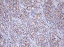 Invitrogen MTIF3 Monoclonal Antibody (OTI1D6) 100 &mu;L; Unconjugated:Antibodies,