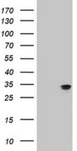 Invitrogen MTIF3 Monoclonal Antibody (OTI1D6) 100 &mu;L; Unconjugated:Antibodies,