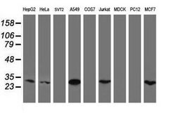 Invitrogen MTIF3 Monoclonal Antibody (OTI1D6) 100 &mu;L; Unconjugated:Antibodies,