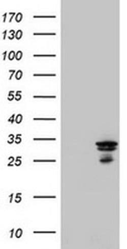 Invitrogen MTIF3 Monoclonal Antibody (OTI4B6) 100 &mu;L; Unconjugated:Antibodies,