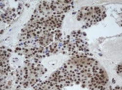 Invitrogen Cullin 4B Monoclonal Antibody (OTI1C4) 100 &mu;L; Unconjugated:Antibodies,