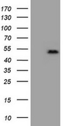 Invitrogen ZSCAN4 Monoclonal Antibody (OTI3B1) 100 &mu;L; Unconjugated:Antibodies,