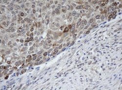 Invitrogen MAGEB1 Monoclonal Antibody (OTI2B12) 100 &mu;L | Buy Online | Invitrogen&trade; | Fisher Scientific