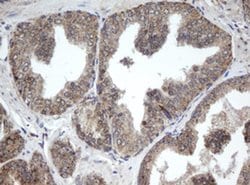 Invitrogen PPT1 Monoclonal Antibody (OTI1A10) 100 &mu;L; Unconjugated:Antibodies,