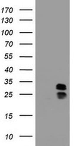 Invitrogen PPT1 Monoclonal Antibody (OTI1A10) 100 &mu;L; Unconjugated:Antibodies,