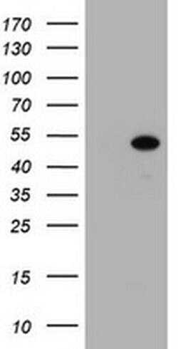 Invitrogen ZSCAN4 Monoclonal Antibody (OTI1A6) 100 &mu;L; Unconjugated:Antibodies,