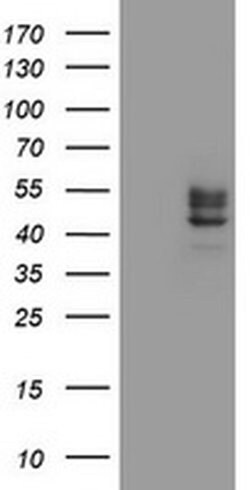Invitrogen CHST6 Monoclonal Antibody (OTI1D1) 100 &mu;L; Unconjugated:Antibodies,