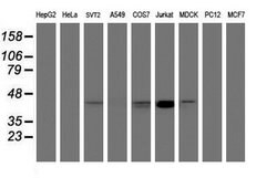 Invitrogen CHST6 Monoclonal Antibody (OTI1D1) 100 &mu;L; Unconjugated:Antibodies,