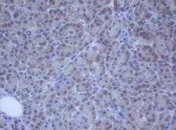 Invitrogen DDX59 Monoclonal Antibody (OTI2G1) 100 &mu;L; Unconjugated:Antibodies,