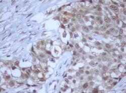 Invitrogen DDX59 Monoclonal Antibody (OTI2G1) 100 &mu;L; Unconjugated:Antibodies,