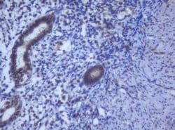 Invitrogen DDX59 Monoclonal Antibody (OTI2G1) 100 &mu;L; Unconjugated:Antibodies,