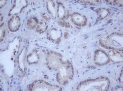 Invitrogen DDX59 Monoclonal Antibody (OTI2G1) 100 &mu;L; Unconjugated:Antibodies,