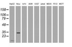 Invitrogen MMADHC Monoclonal Antibody (OTI1G4) 100 &mu;L; Unconjugated:Antibodies,