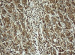 Invitrogen PPT1 Monoclonal Antibody (OTI1F10) 100 &mu;L; Unconjugated:Antibodies,