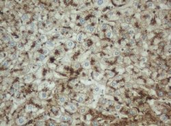 Invitrogen PPT1 Monoclonal Antibody (OTI1F10) 100 &mu;L; Unconjugated:Antibodies,