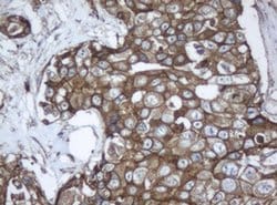 Invitrogen PPT1 Monoclonal Antibody (OTI1F10) 100 &mu;L; Unconjugated:Antibodies,