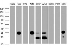 Invitrogen PPT1 Monoclonal Antibody (OTI1F10) 100 &mu;L; Unconjugated:Antibodies,