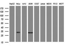Invitrogen ING2 Monoclonal Antibody (OTI1E12) 100 &mu;L | Buy Online | Invitrogen&trade; | Fisher Scientific