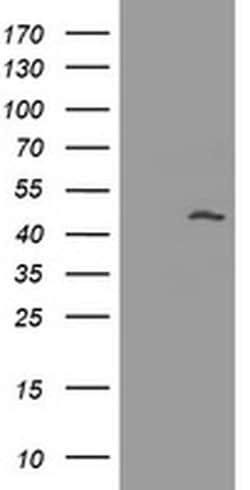 Invitrogen MAGEA3 Monoclonal Antibody (OTI1G9) 100 &mu;L; Unconjugated:Antibodies,