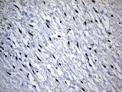 Invitrogen SATB2 Monoclonal Antibody (OTI7E11) 100 &mu;L; Unconjugated:Antibodies,