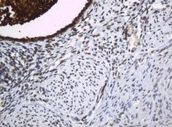 Invitrogen WFDC2 Monoclonal Antibody (OTI1E12) 100 &mu;L | Buy Online | Invitrogen&trade; | Fisher Scientific