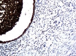 Invitrogen WFDC2 Monoclonal Antibody (OTI1B9) 100 &mu;L | Buy Online | Invitrogen&trade; | Fisher Scientific