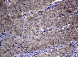 Invitrogen RRM1 Monoclonal Antibody (OTI5G5) 100 &mu;L | Buy Online | Invitrogen&trade; | Fisher Scientific