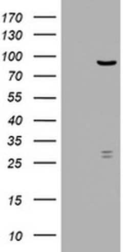 Invitrogen RRM1 Monoclonal Antibody (OTI5G5) 100 &mu;L | Buy Online | Invitrogen&trade; | Fisher Scientific