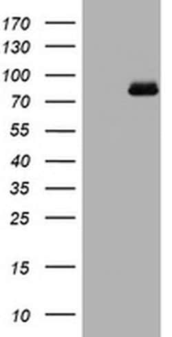 Invitrogen POLI Monoclonal Antibody (OTI1C8) 100 &mu;L | Buy Online | Invitrogen&trade; | Fisher Scientific